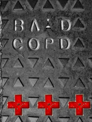 Лицьова сторона