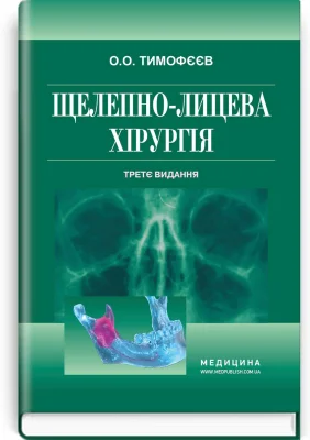 Щелепно-лицева хірургія
